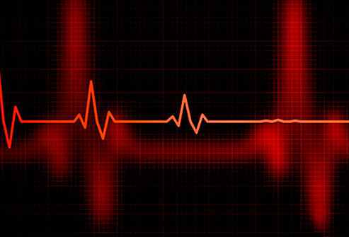 heart monitor