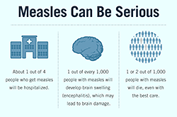 measles-can-be-serious.png